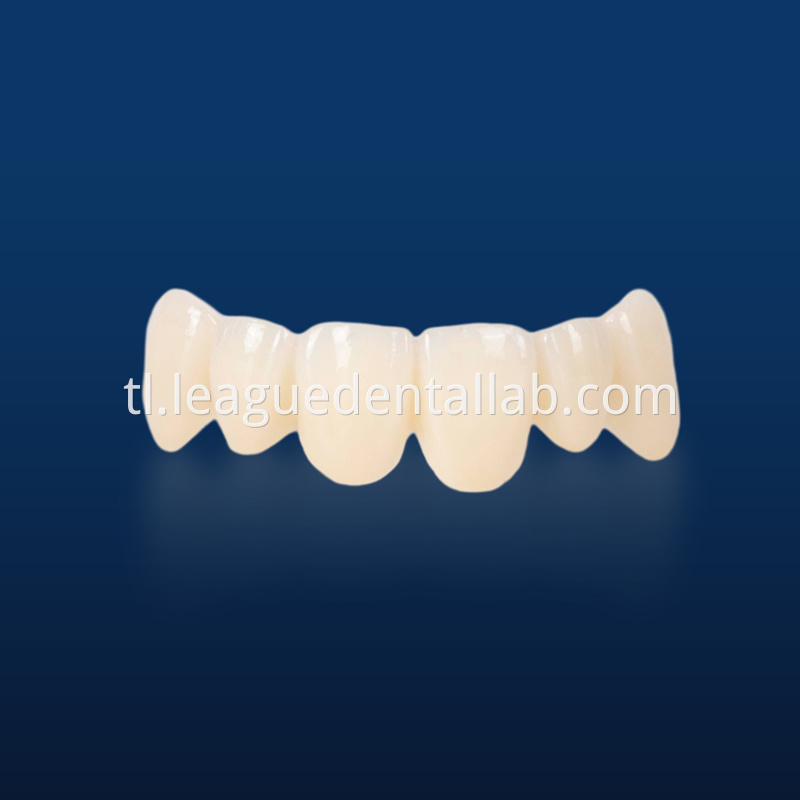 PFZ,Porcelain Fused to Zirconia,Zirconia Layered, Zirconia Veneered